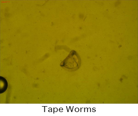 Tape Worms